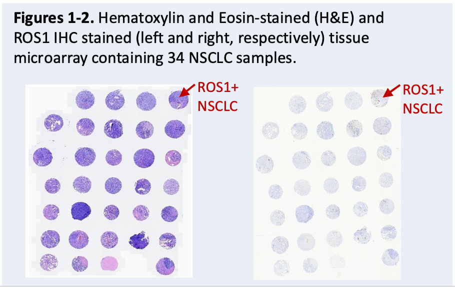 Frozen plasma, buffy coat, FFPE blocks and slides