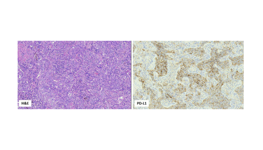 Frozen plasma, buffy coat, FFPE blocks and slides