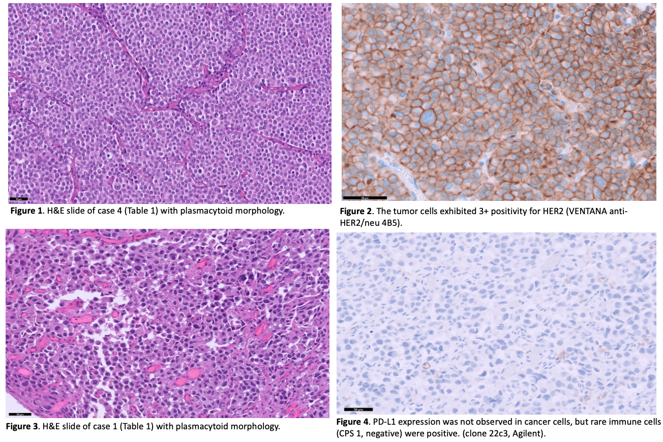 Frozen plasma, buffy coat, FFPE blocks and slides