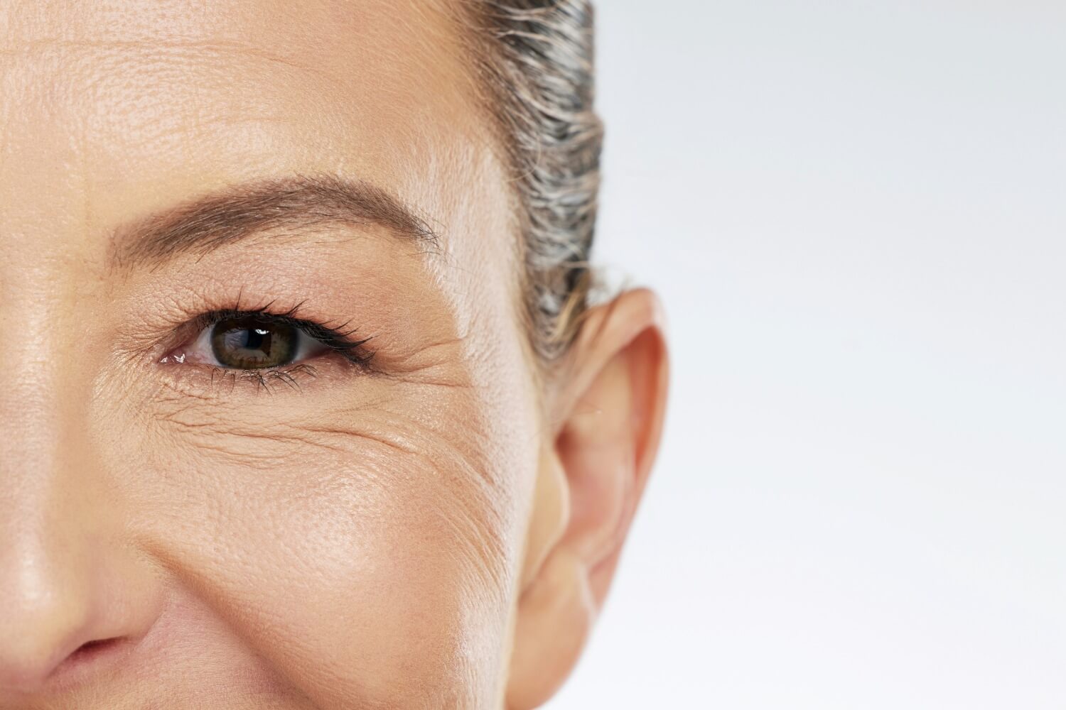 Close-up of the left side of a mature woman's face, highlighting crow's feet wrinkles around her eye and a smooth complexion, suggesting she may be a candidate for Botox treatment.