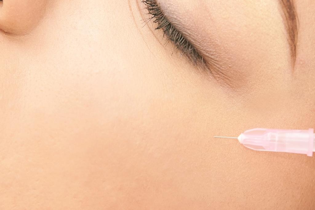 rejuran-treatment-by-needle-injection