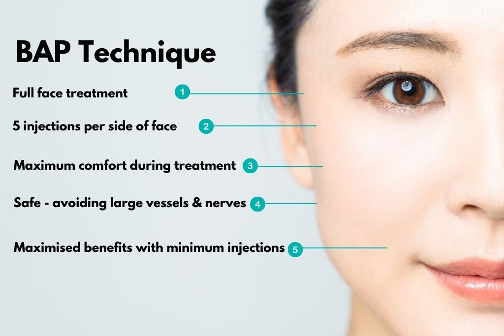profhilo-using-bap-technique