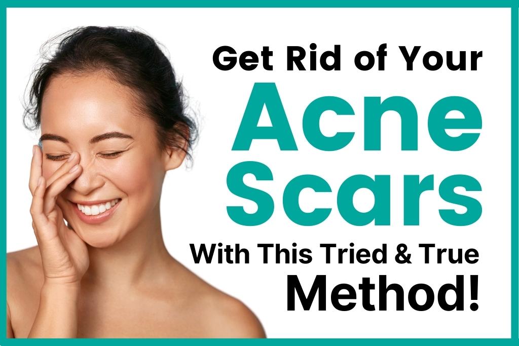 5 Ways Rejuran S Can Help Revitalize Your Skin