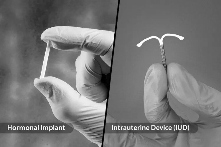 Nexplanon Contraceptive Implants