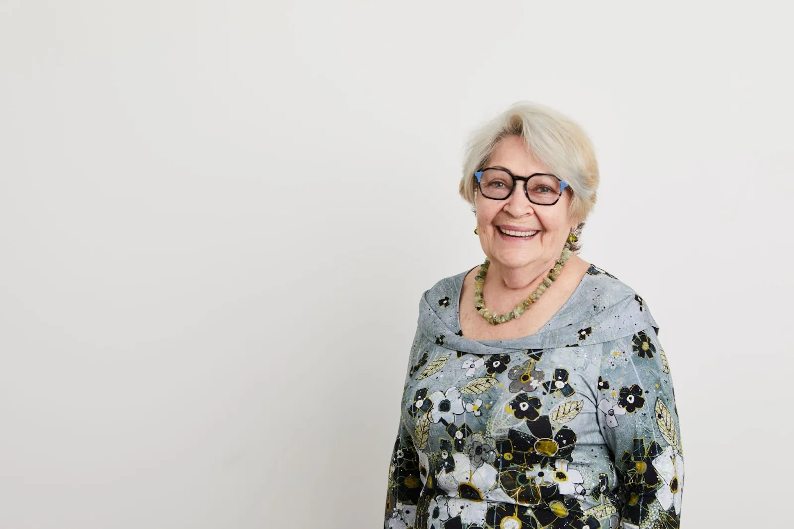 After All-on-4 dental implants