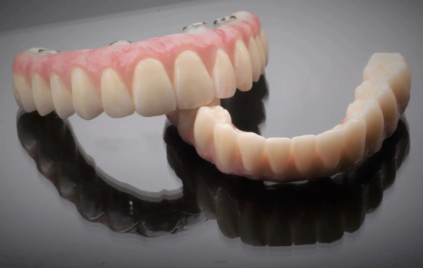 An image of an All-on-4 tooth bridge.