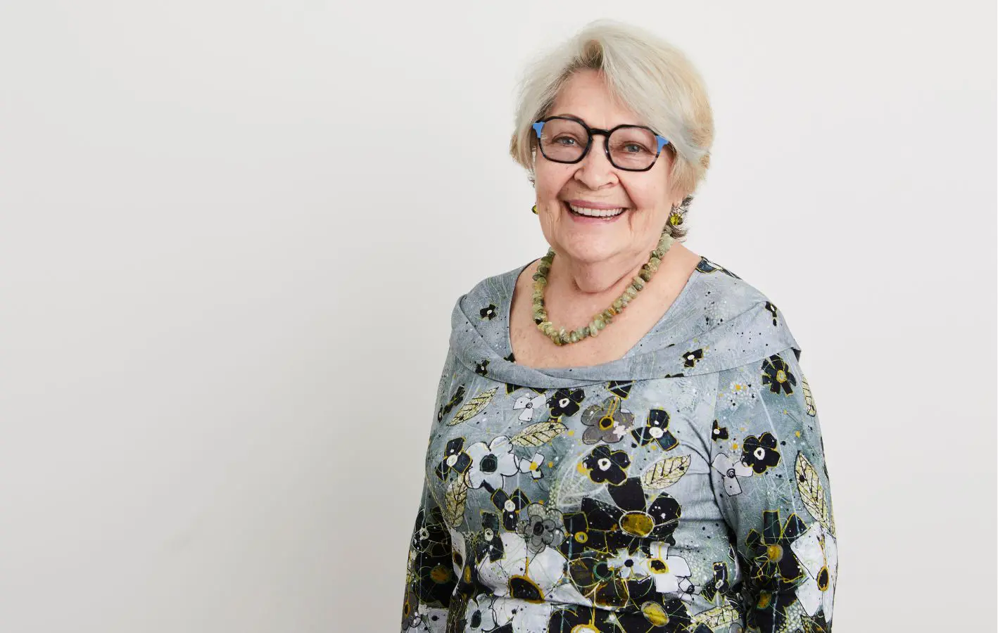 After All-on-4 dental implants