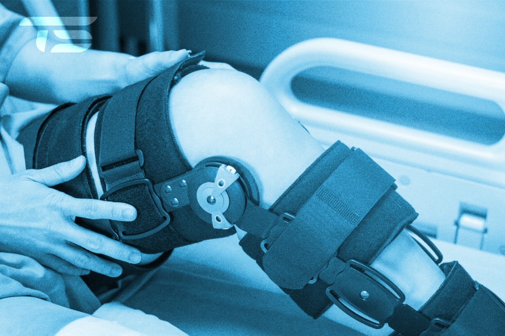 Complete ACL Recovery Timeline Guide from 3 Months to Competition