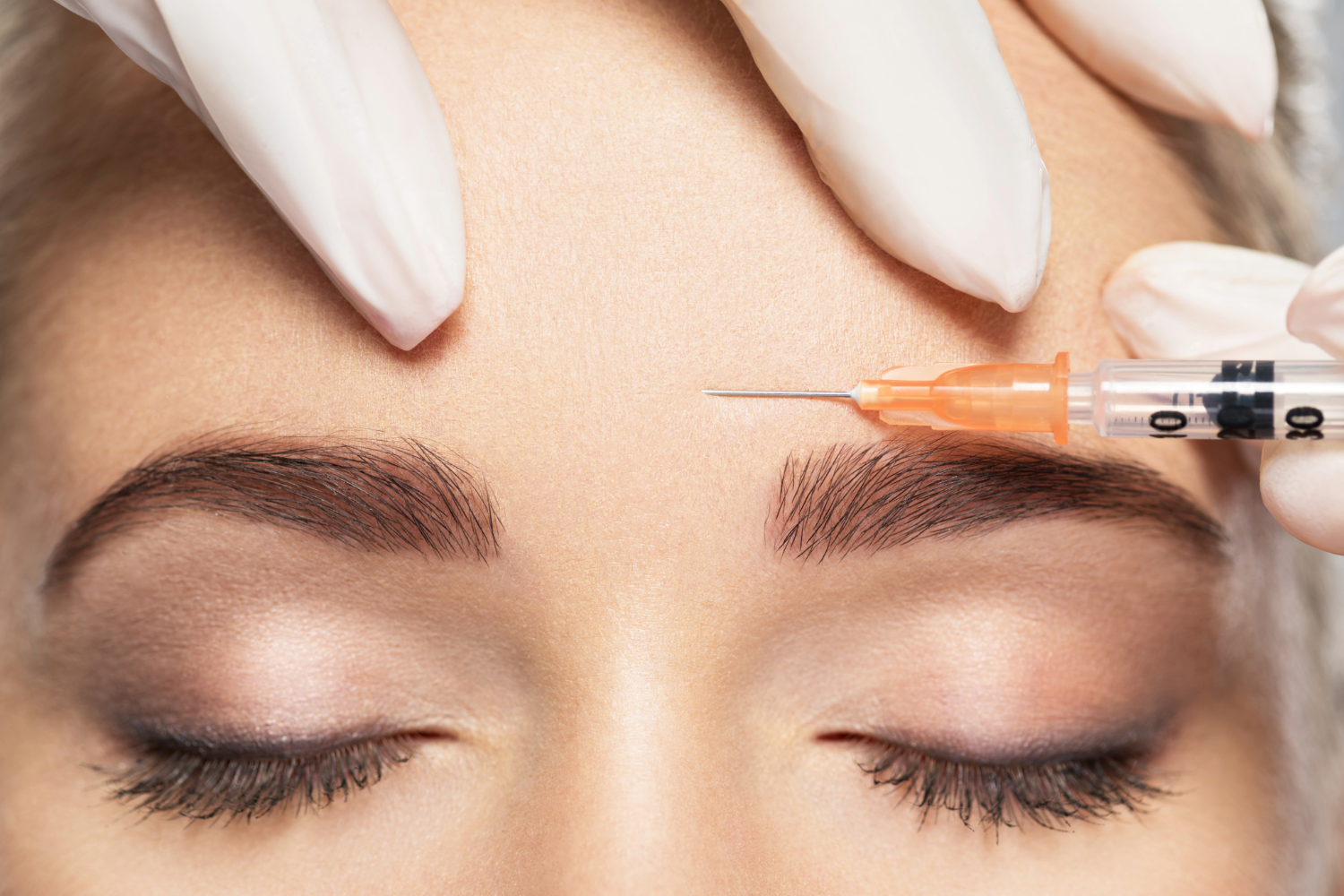 Syringe injecting forehead near eyebrows.