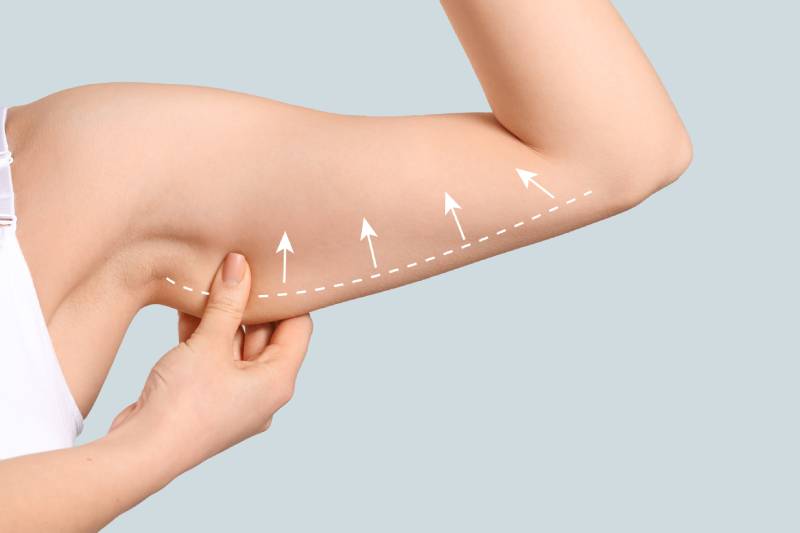 Arm with tightening arrows 표시됨
