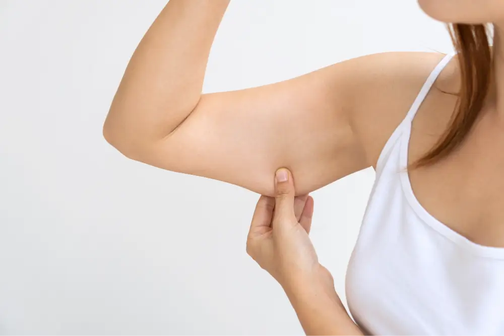 Woman pinching arm fat.