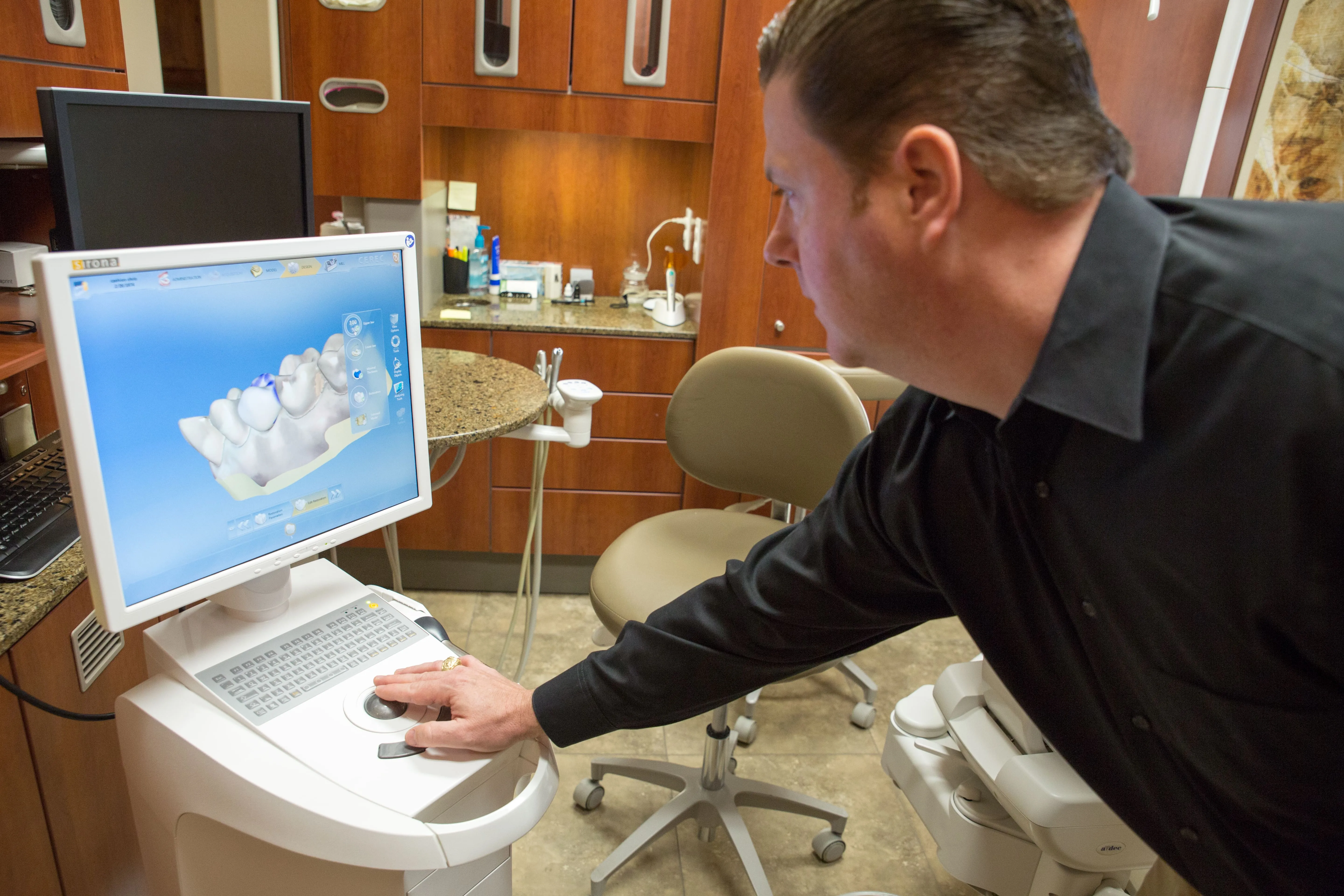 CEREC® 