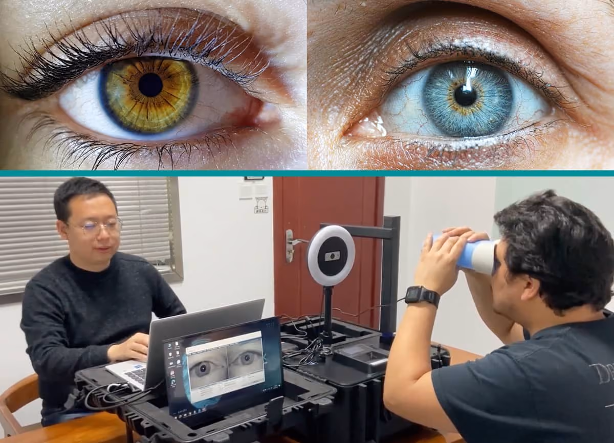 Iris Patterns and Iris Recognition by Aratek Biometrics Enrollment Kit
