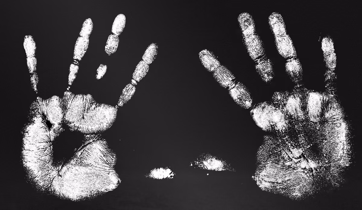 Palm Vein Scans