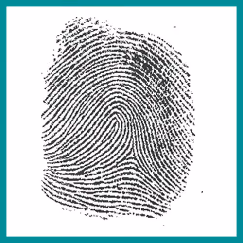 Fingerprint Patterns – Redial loop