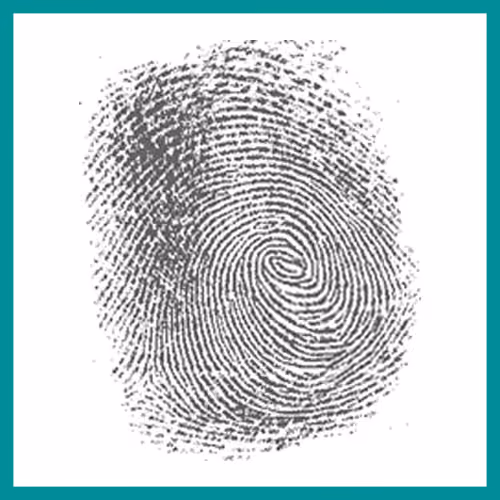 Fingerprint Patterns – Accidental whorl