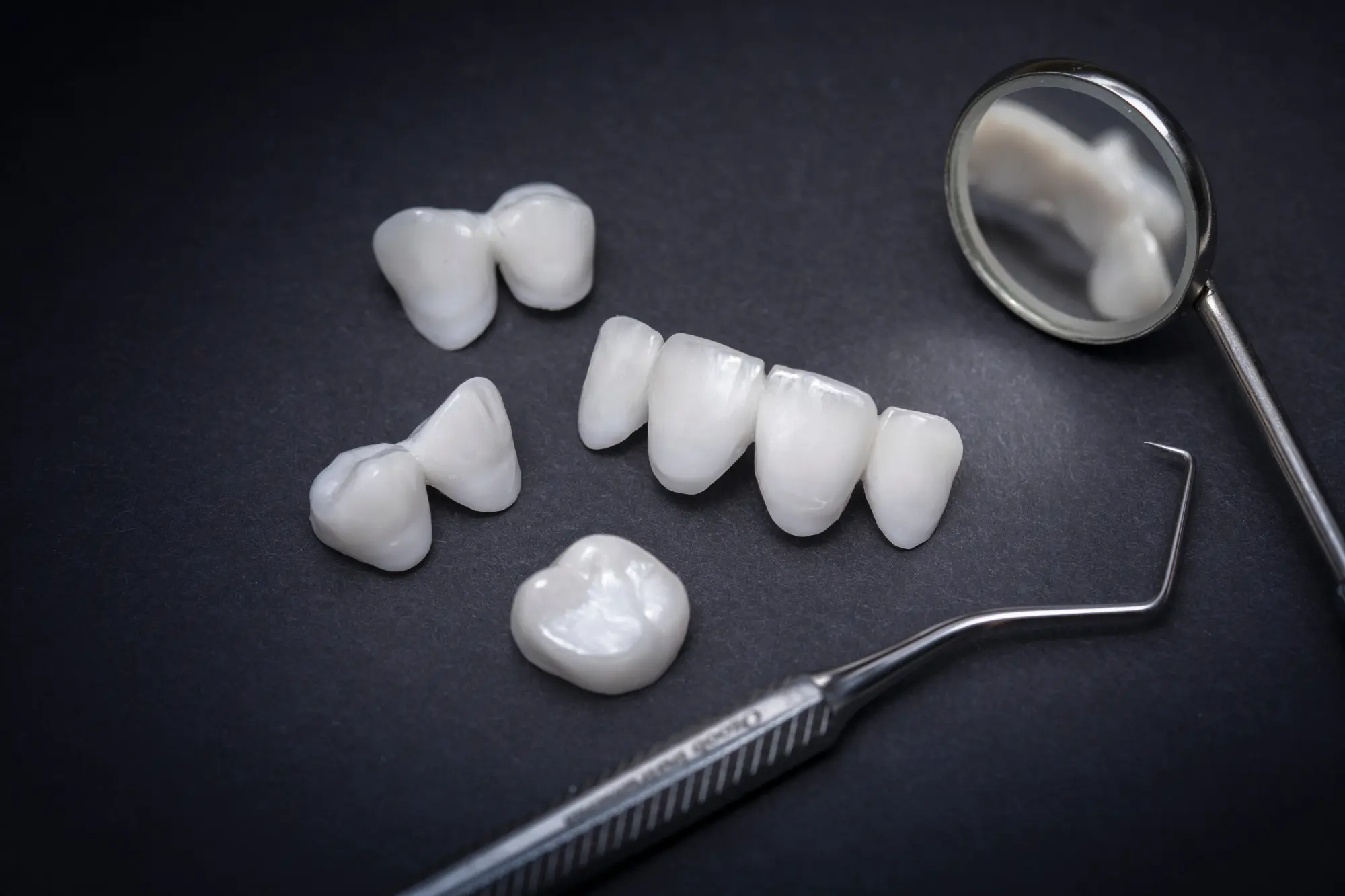 Porcelain Veneers in Brookfield: Achieving a Flawless Smile Makeover