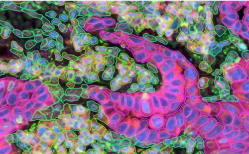 Spatially resolved transcriptomics imagery