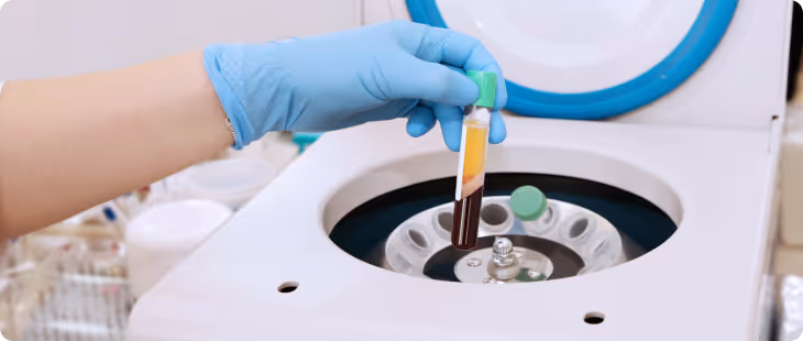 Regenerative Medicine Therapy clinic in Long Beach.