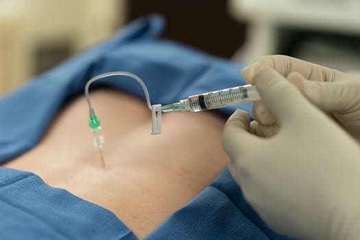 Herniated Disc Injection Treatment
