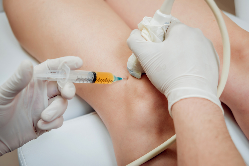 Fibromyalgia Injection Treatment