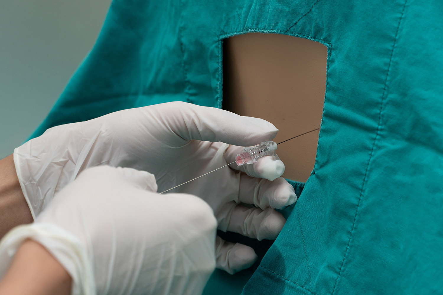 Interventional Treatment for Back Pain