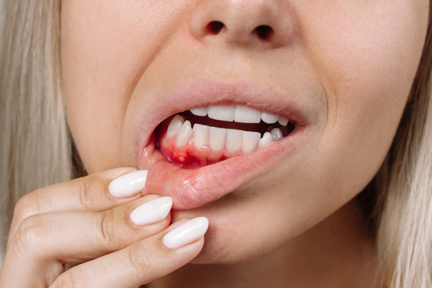 dental implants after gum disease