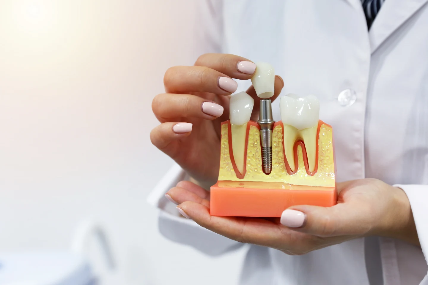 dental implants and diabetes