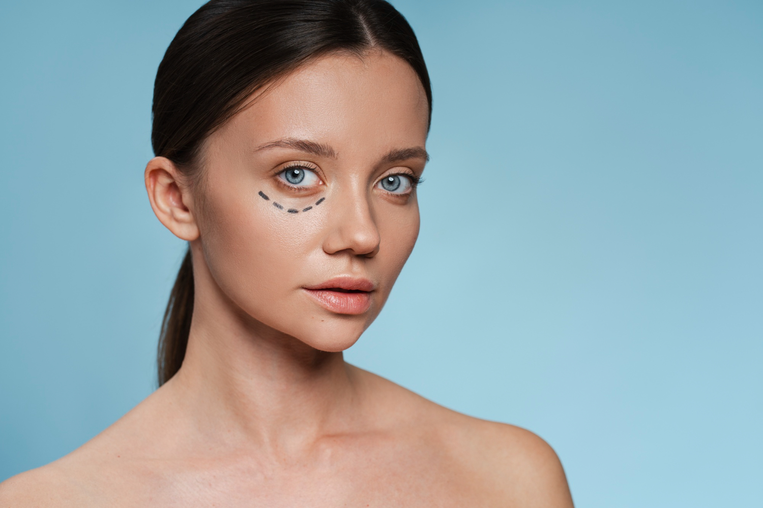 Under-Eye Rejuvenation Dubai | Dark Circles, Tear Trough & Skin Quality
