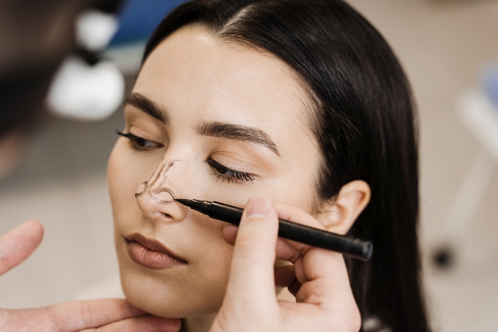 Revision Rhinoplasty in Dubai – Corrective Nose Surgery
