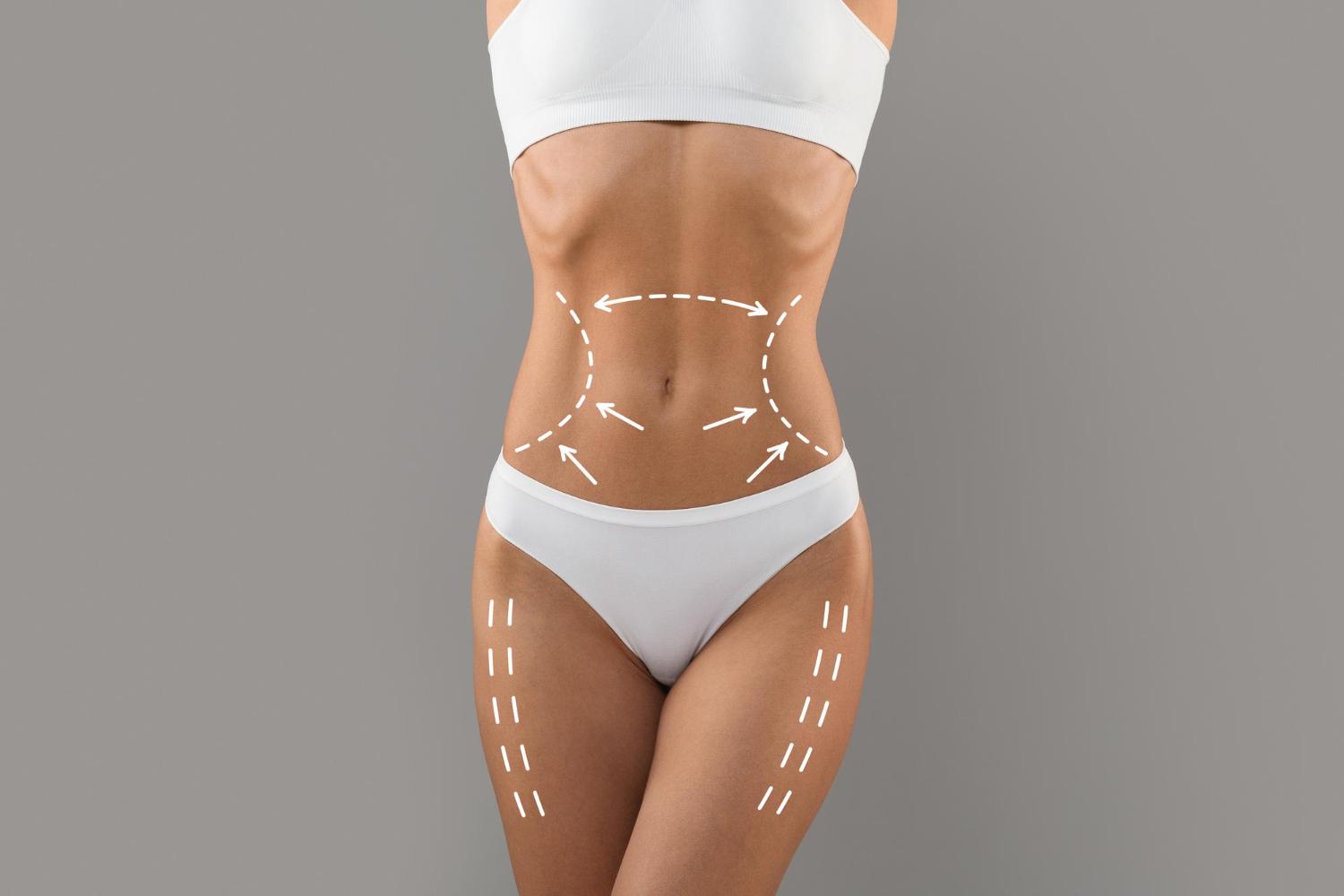 Liposuction in Dubai | Procedure, and Recovery Guide