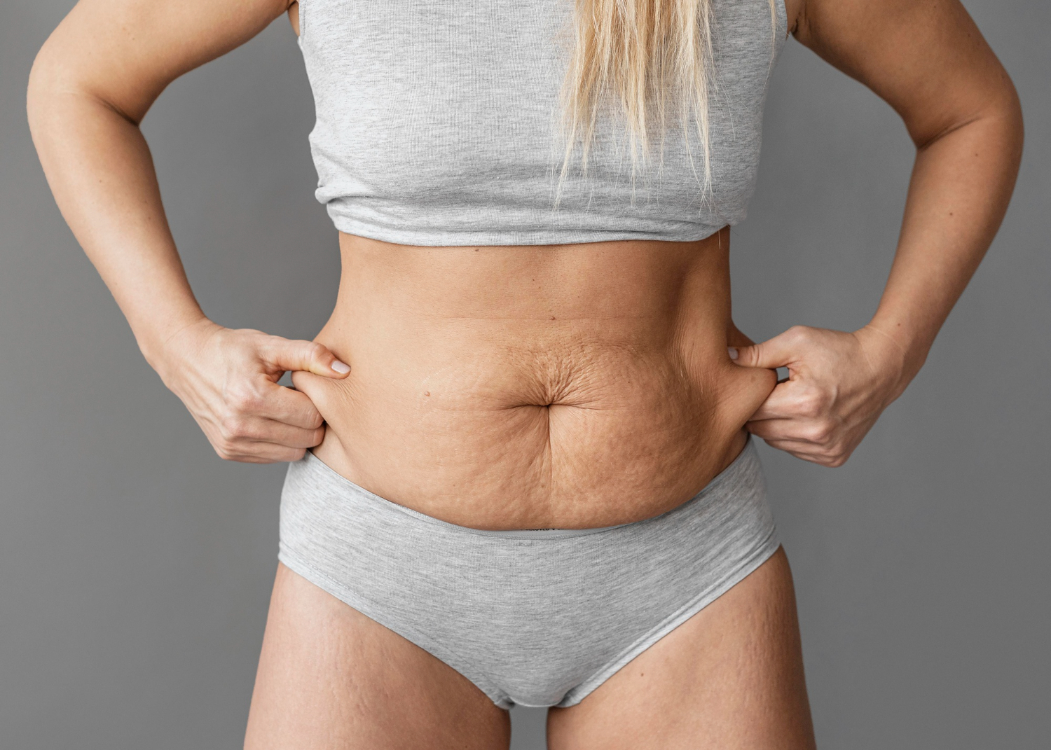 Mommy Makeover in Dubai | Week-by-Week Recovery Guide