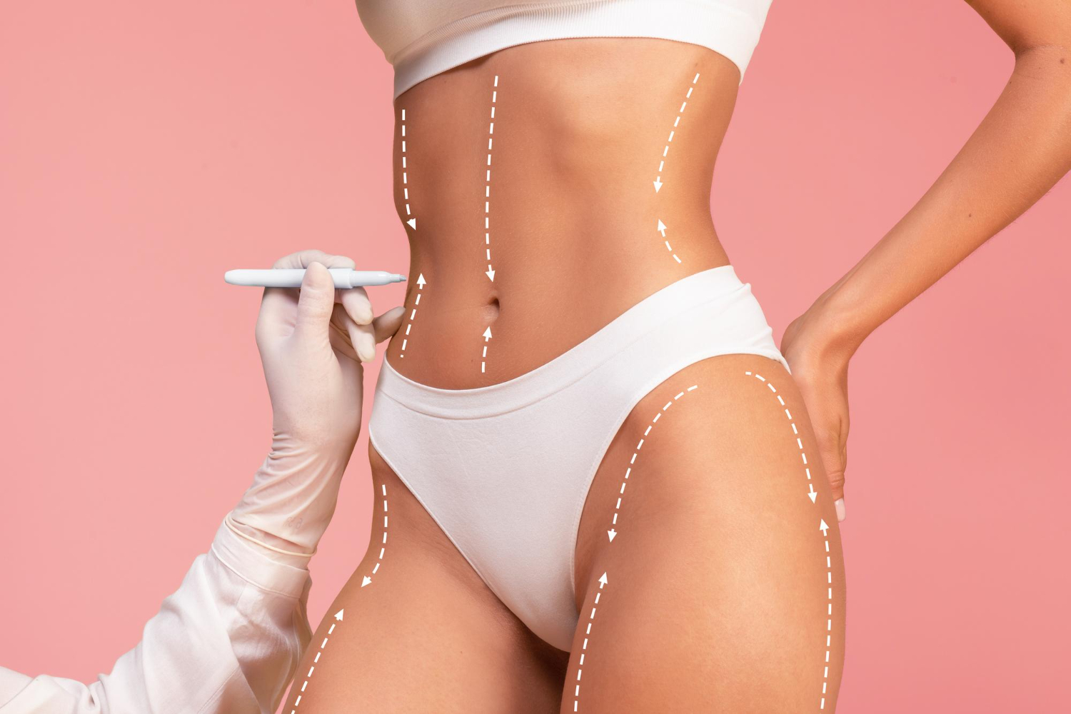 HOW TO PLAN FOR LIPOSUCTION BEFORE AND AFTER