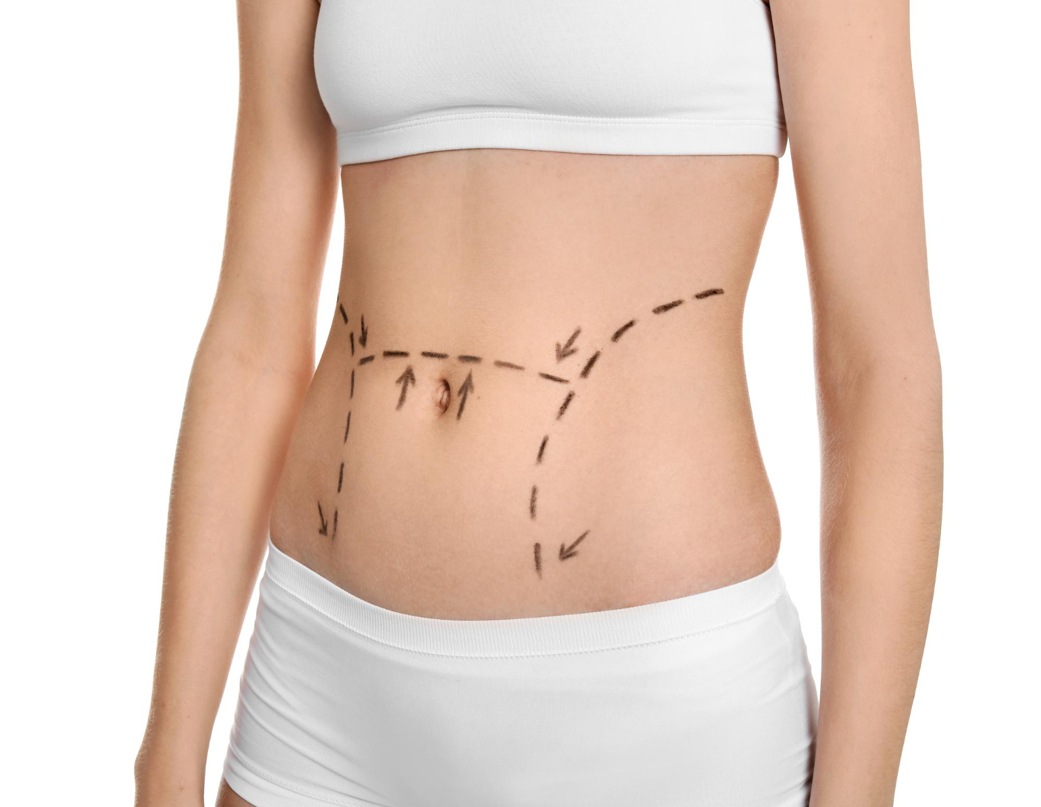 Tummy Tuck 101 Everything You Need to Know About A Tummy Tuck in Dubai
