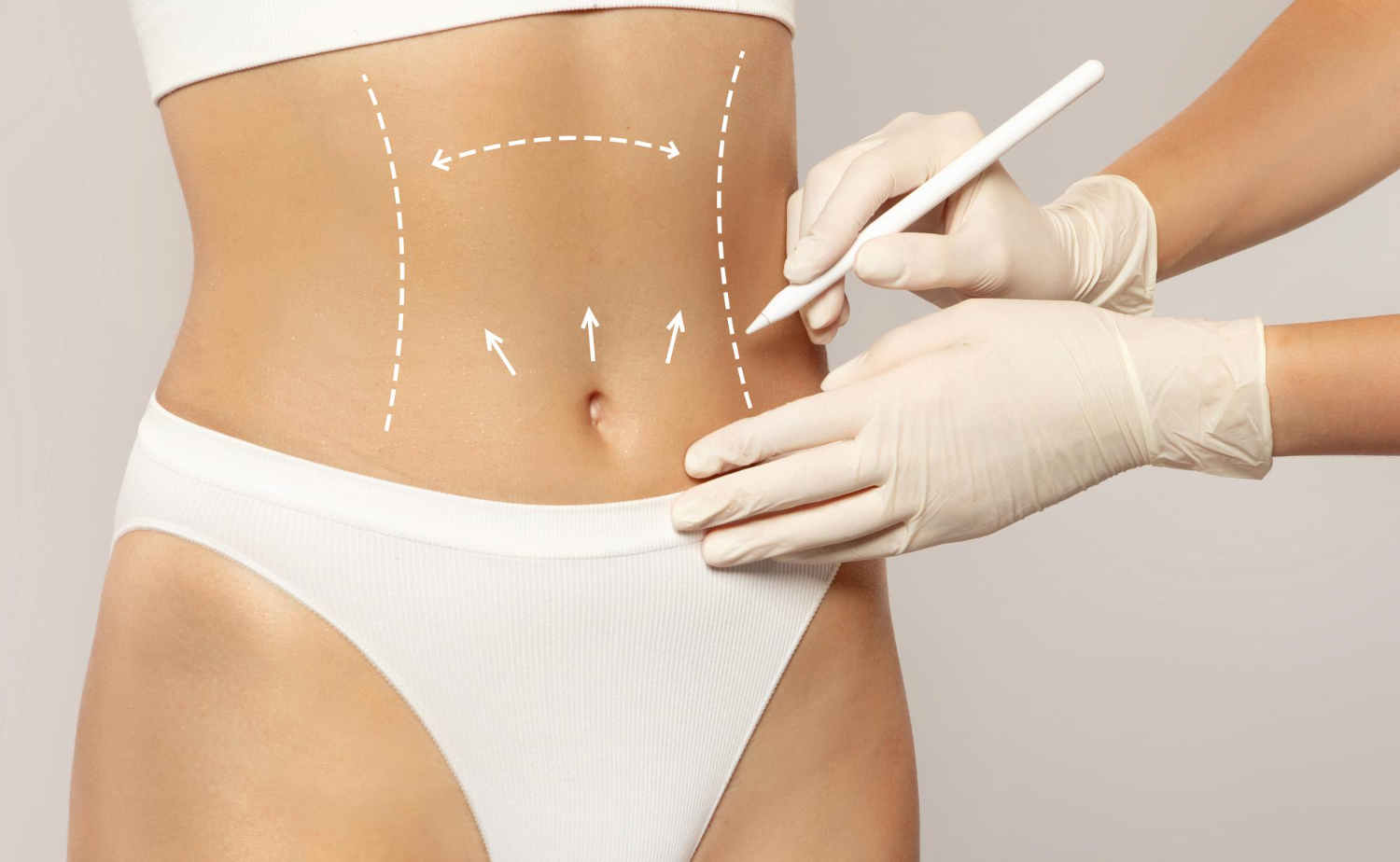 Full vs. Mini Tummy Tuck: Understanding the Differences