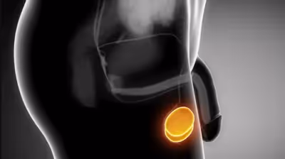 Kirurška vstavitev testikularne proteze