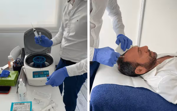 Pomlajevanje obraza s plazmo Fabjan