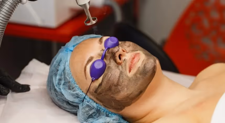 Ženska leži med laserskim tretmajem obraza za akne.