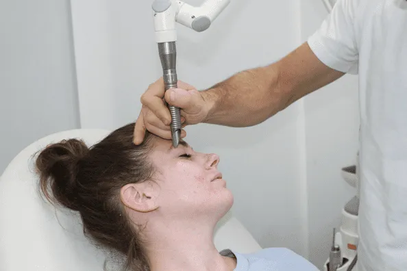 lasersko zdravljenje aken fabjan