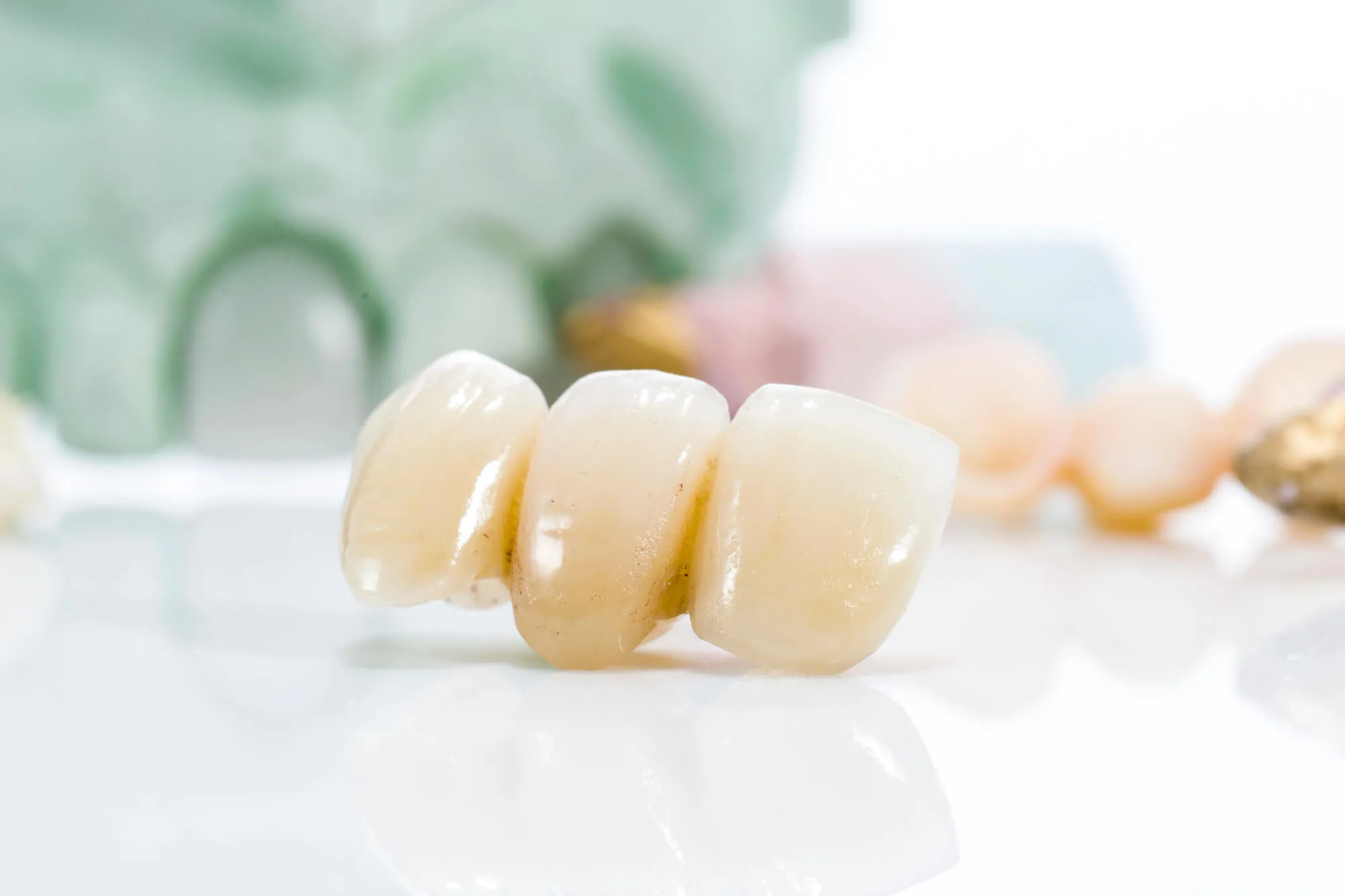 Dental bridges college station tx