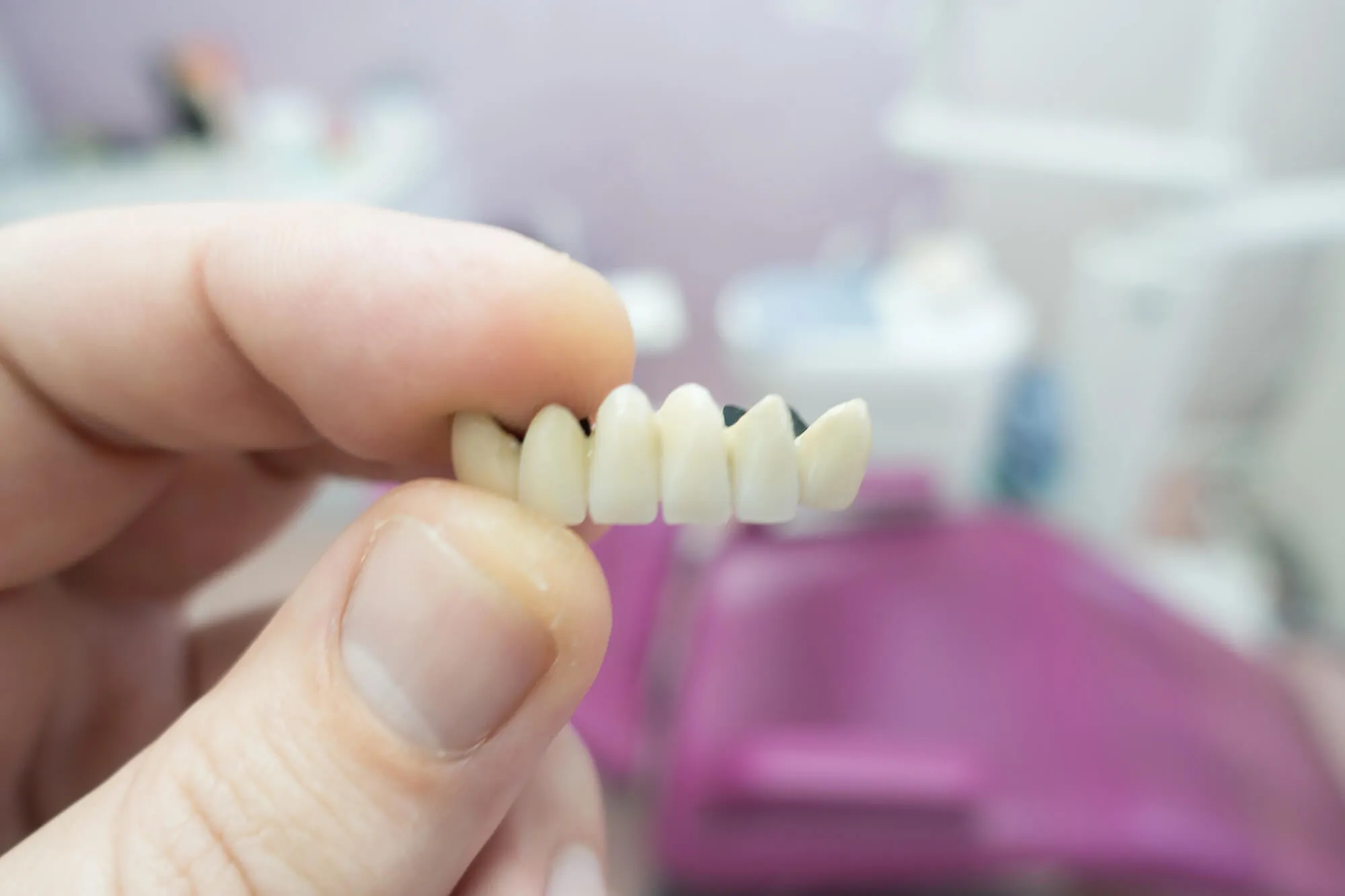 dentist holding Dental bridges college station tx