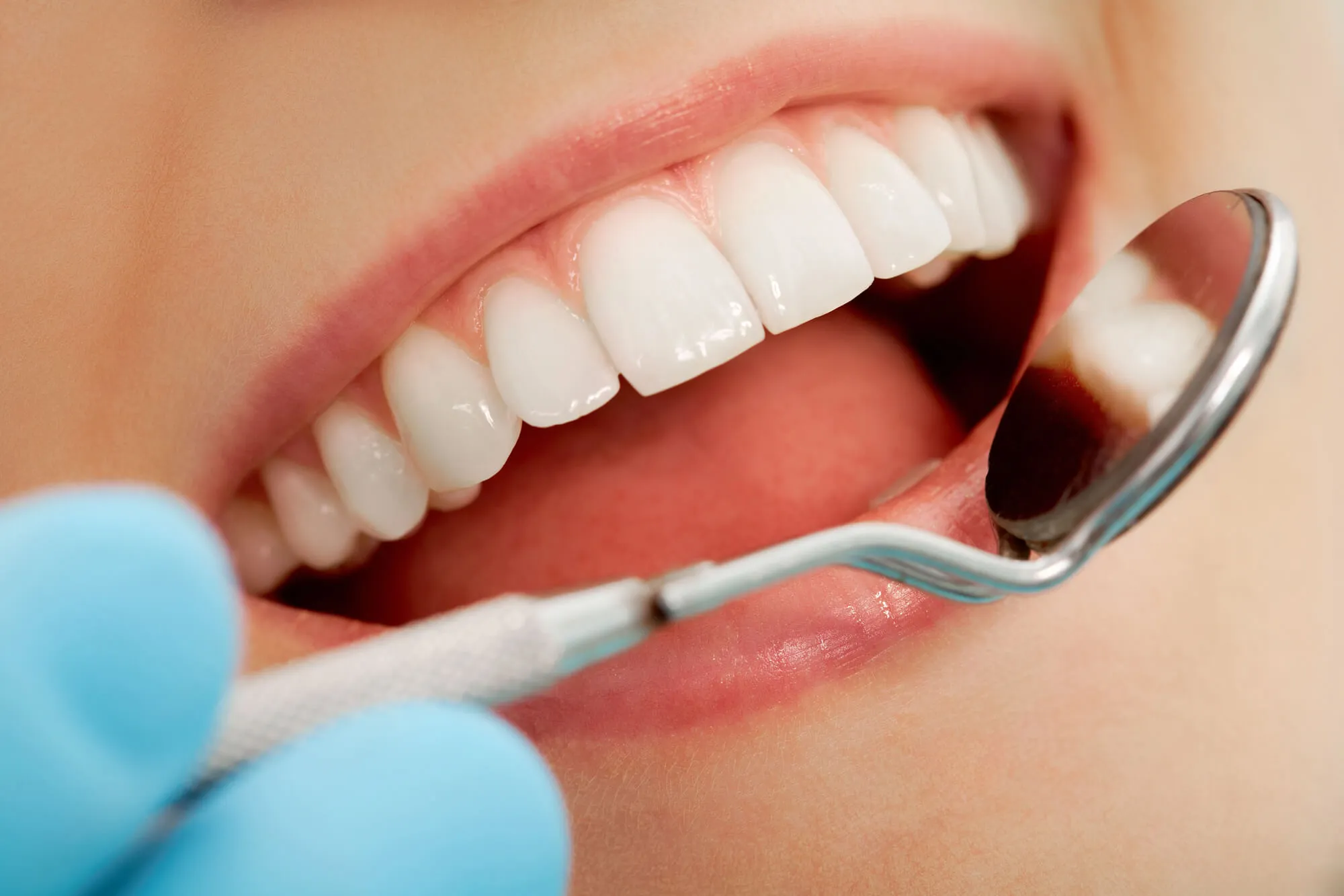 Why Some Teeth Respond Differently to Whitening Treatments