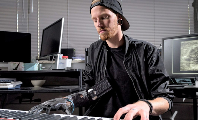 Prótesis e IA, nueva alternativa para PCD – Consumotic