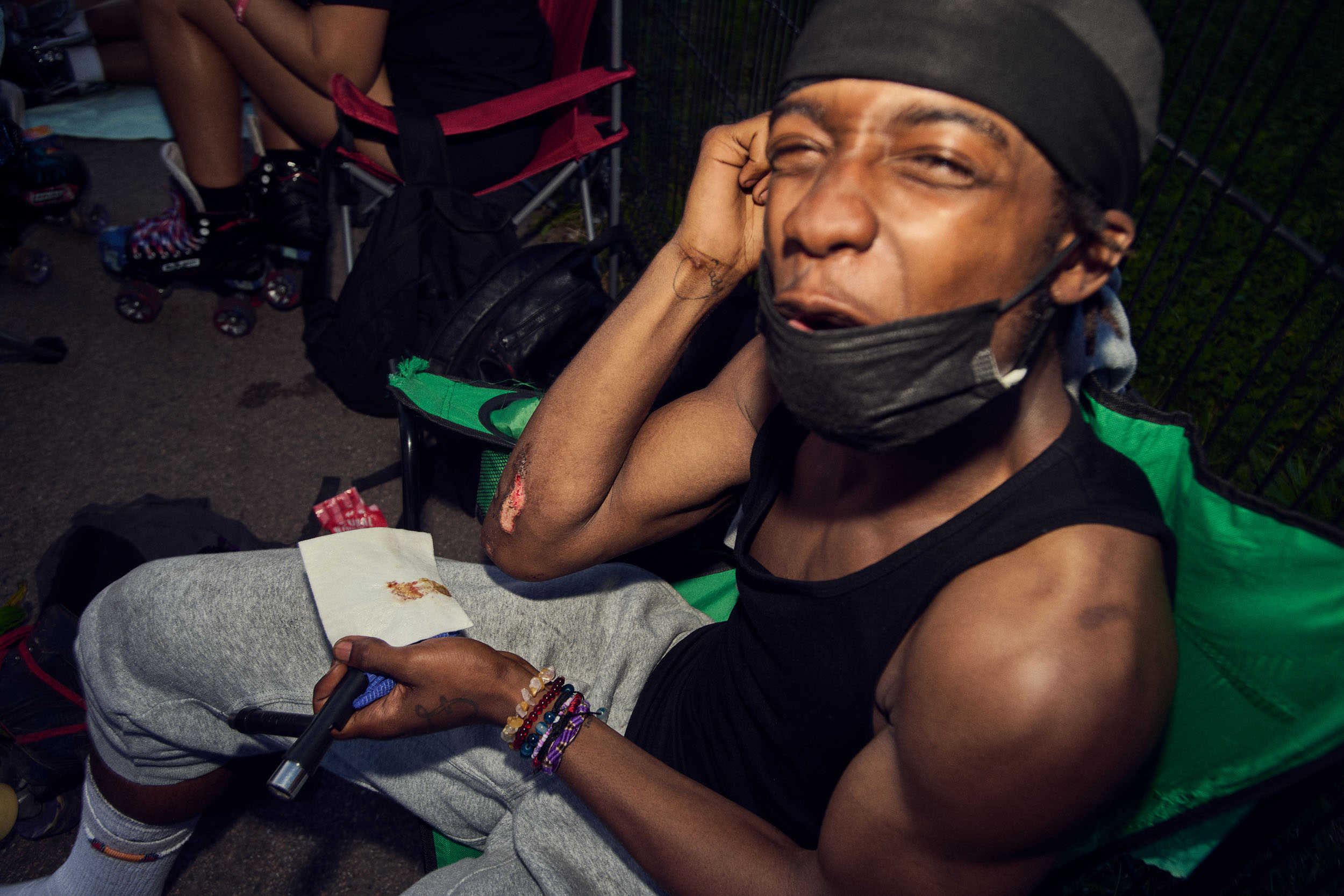 A skater rests in a camping chair with a grazed elbow after coming off the tarmac.