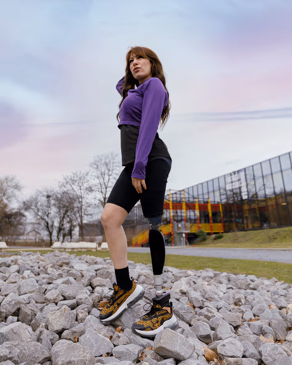 Woman with a prosthetic leg standing on gray rocks outdoors near modern building.