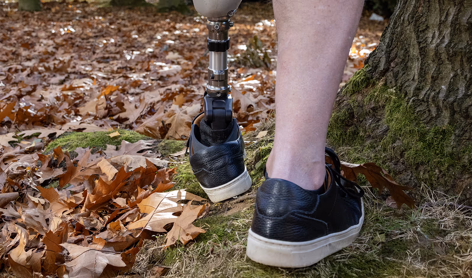 Close-up of a person's lower legs outdoors, one leg with a prosthetic limb wearing a black shoe, the other leg bare with a matching black shoe standing on moss and leaves and uneven terrain adaptation