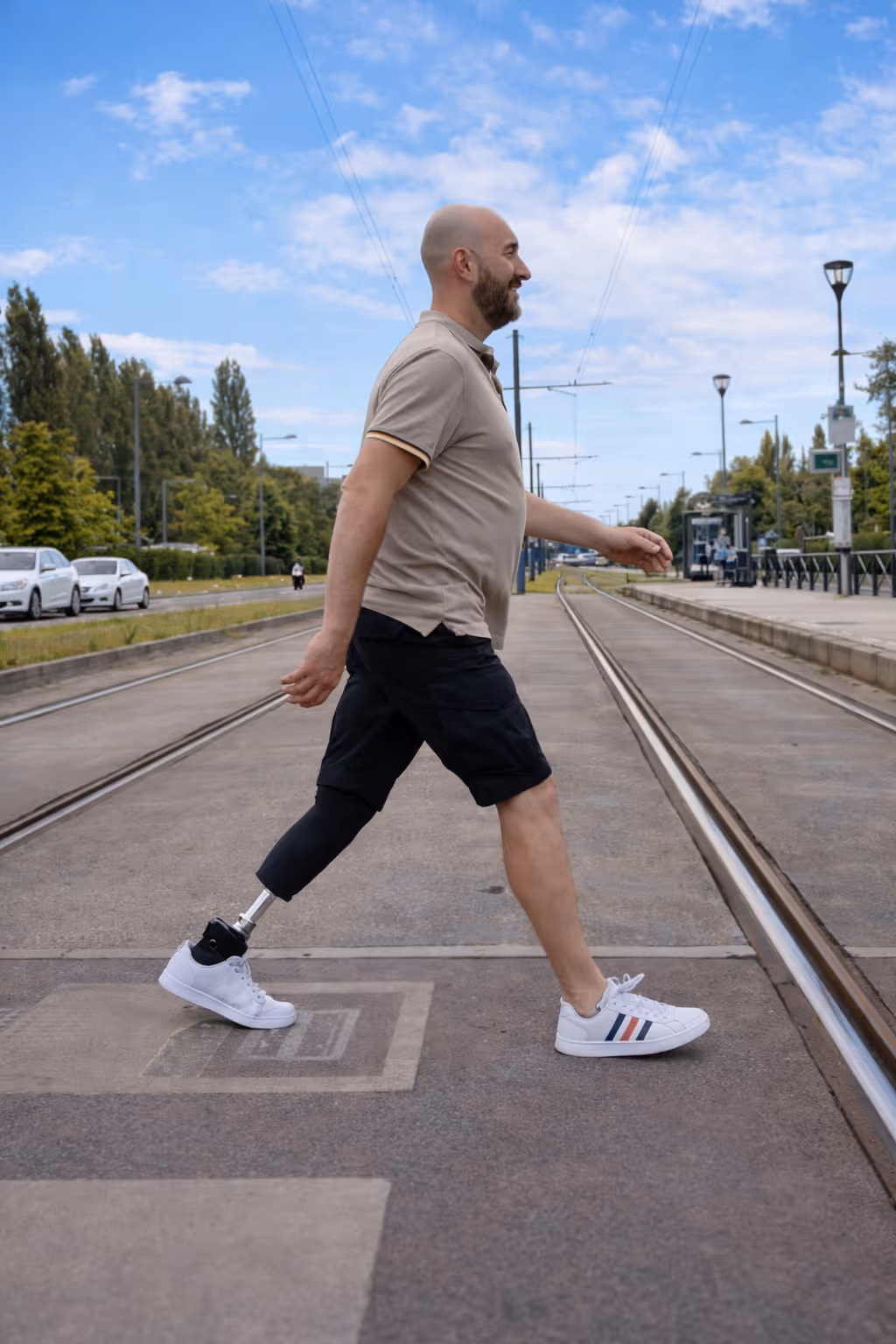 Man with a prosthetic leg walking across tram tracks on a city street under a blue sky with clouds.