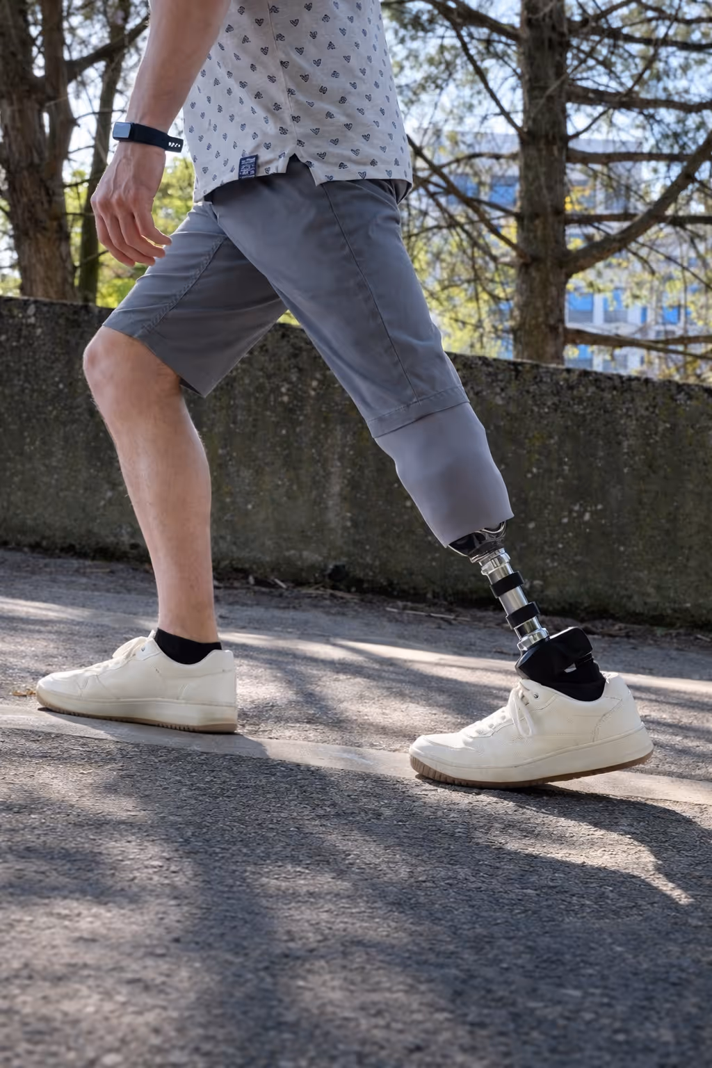 Person walking outdoors wearing shorts and a prosthetic leg with a white sneaker.