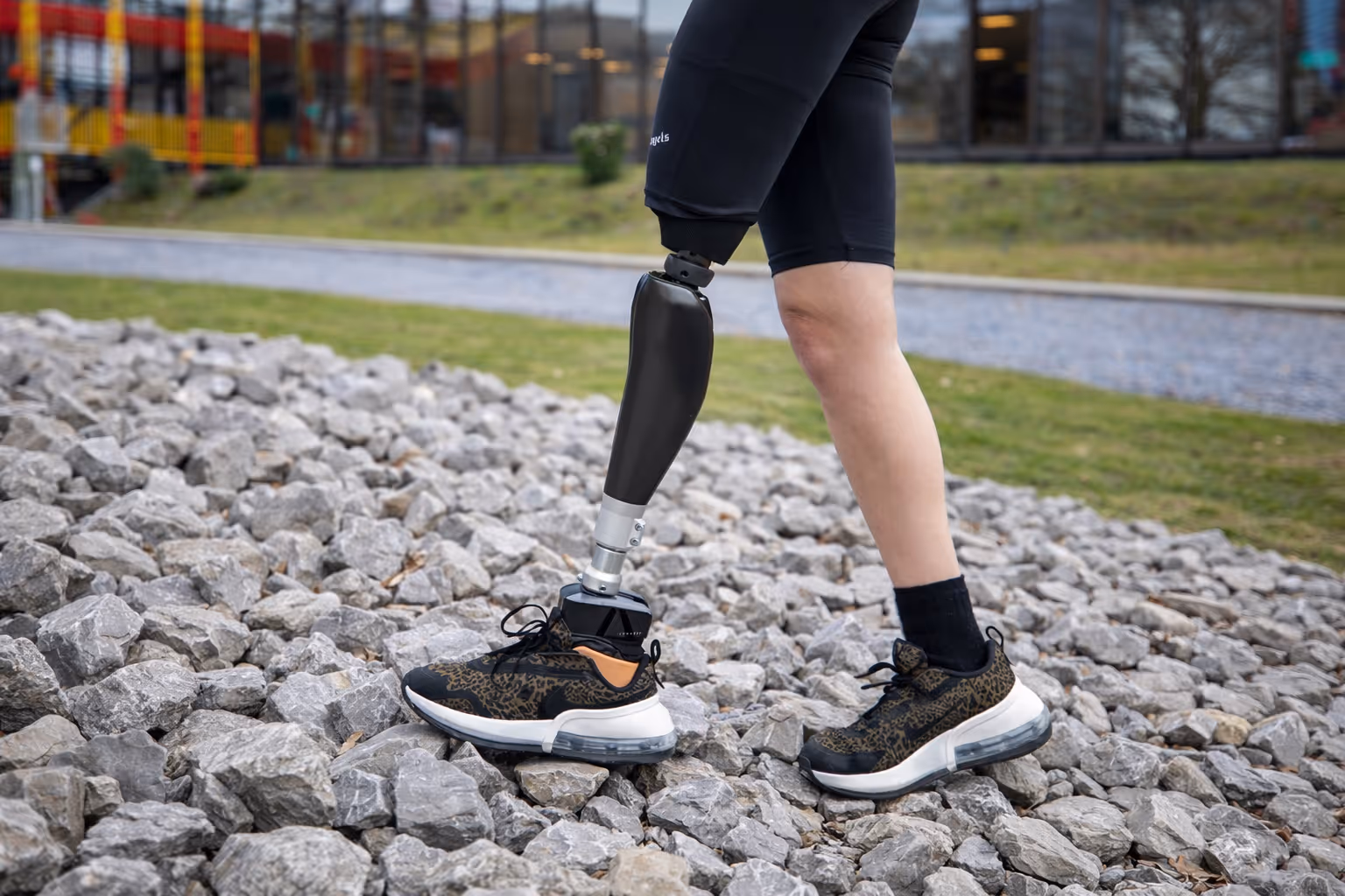 Person with a black prosthetic leg wearing animal print sneakers standing on gray rocks outdoors.