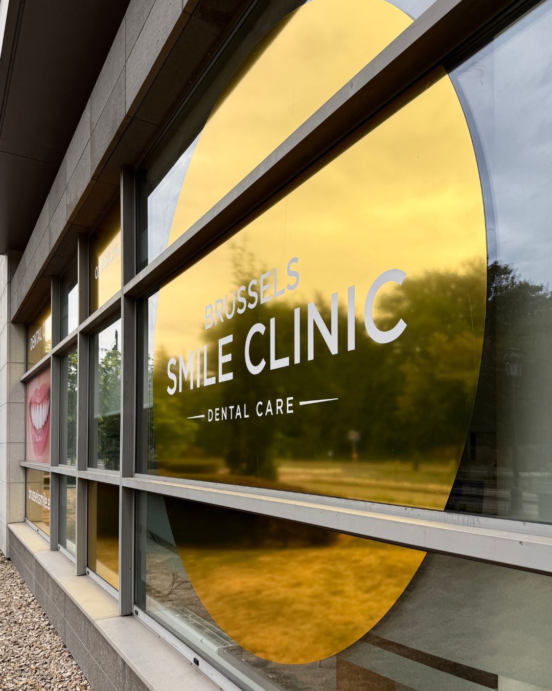 Raamstickers Brussels Smile Clinic